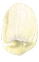 Interferencia de oro -  N/A